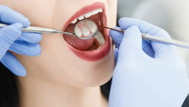 Uzmanı açıkladı: Diş eti hastalıkları kalp ve alzheimer riskiyle alakalı olabilir