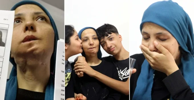 Üç çocuk annesi bayan 11 yılda 35 ameliyat geçirdi: Son ameliyatı olmazsa lisanı alınacak