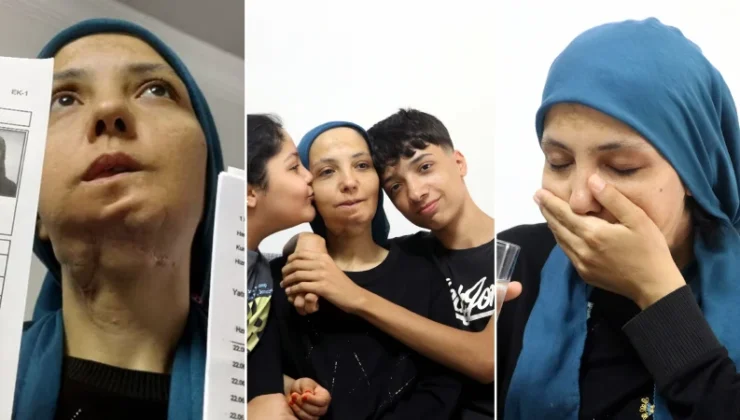 Üç çocuk annesi bayan 11 yılda 35 ameliyat geçirdi: Son ameliyatı olmazsa lisanı alınacak